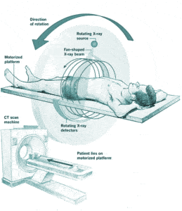 CT machine diagram