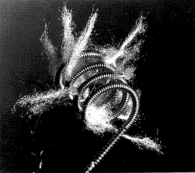 The Gianturco coil
