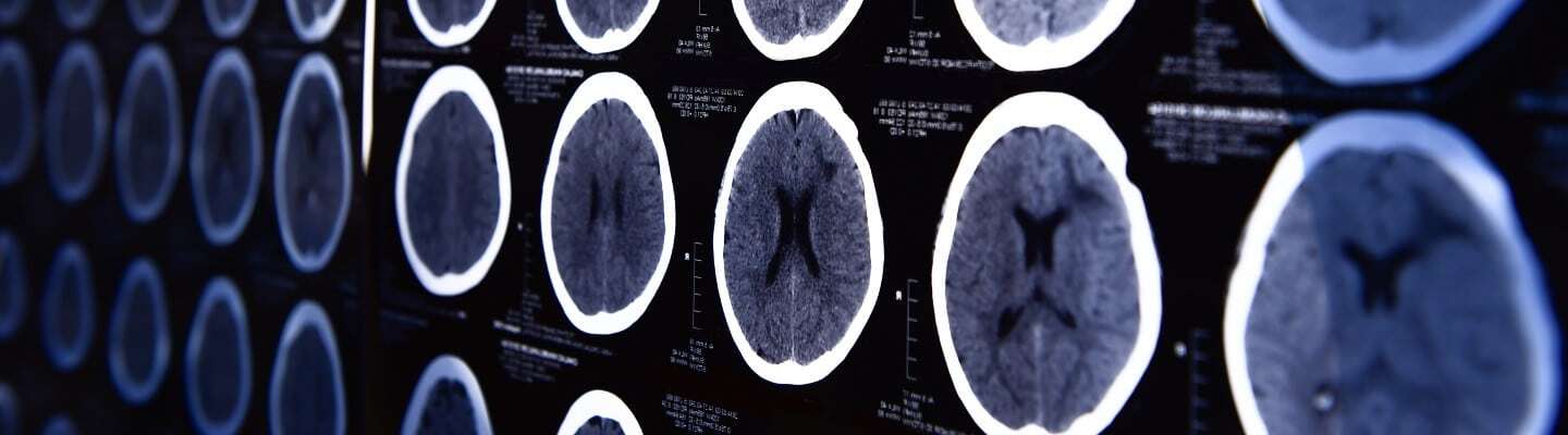 CT Scanner Slices and What are Their Differences?