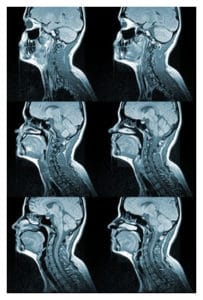 Preparation for an MRI Scan