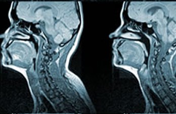 mri scan