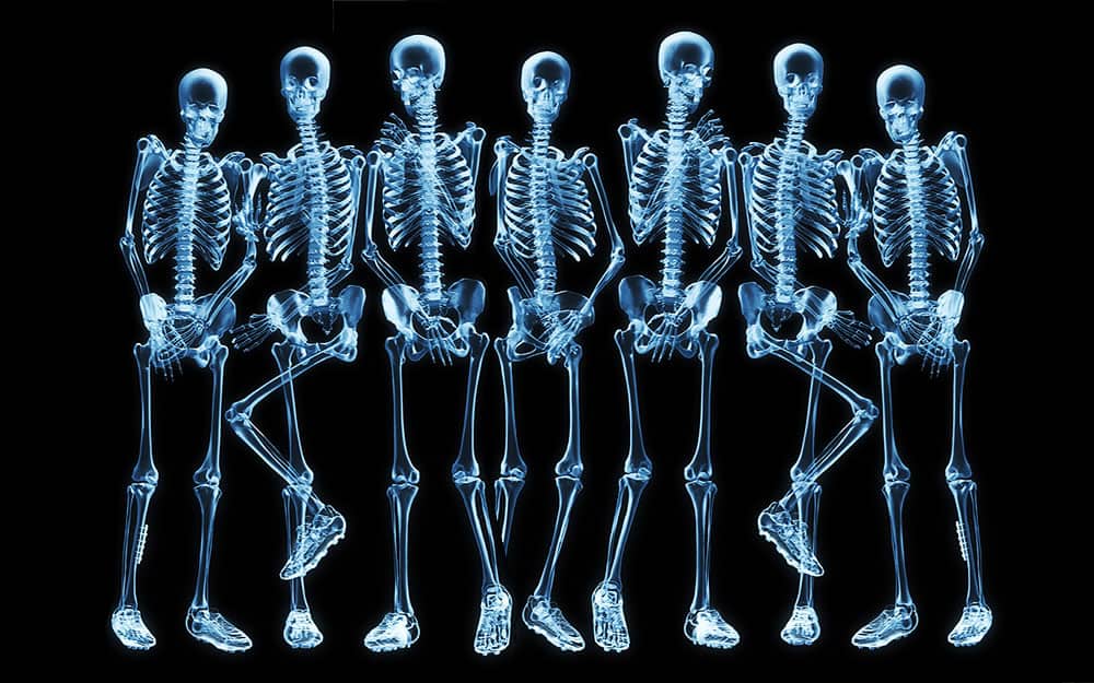 Fun Facts about Radiology History