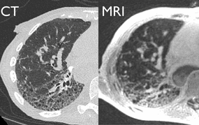 CT and MRI scans comparison 