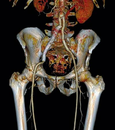3D The Next Big Thing in Diagnostic Imaging