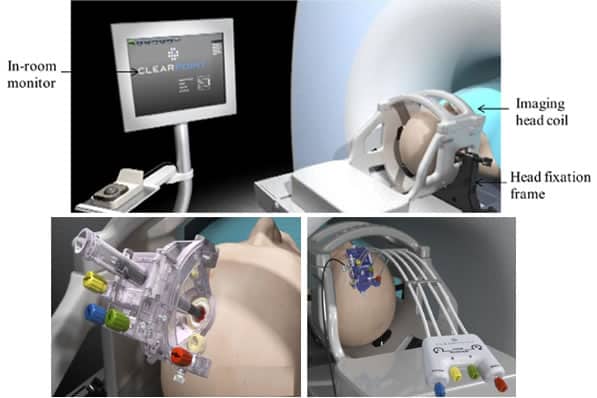mri scanner