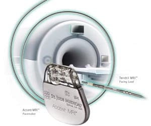 MRI scan safety