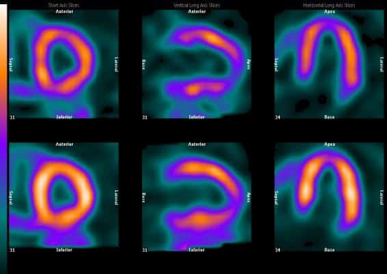 Radiation Imaging