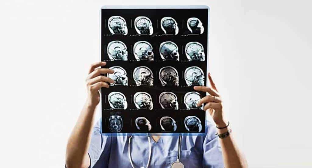 Study shows modern radiologists don't face greater death risk