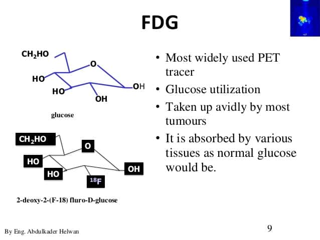 PET/CT Tracer (FDG)
