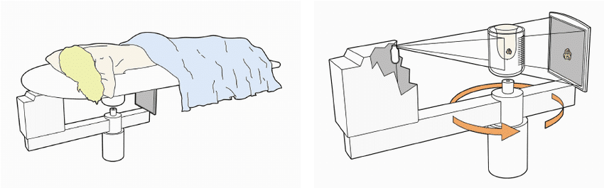 Illustration of dedicated cone-beam breast CT X-ray tube and detector