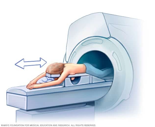 Illustration of a breast MRI procedure