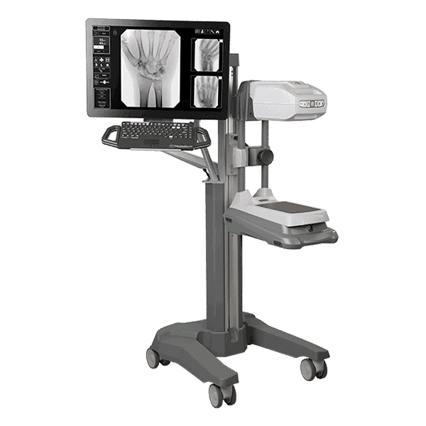 orthoscan hd mini c-arm side view