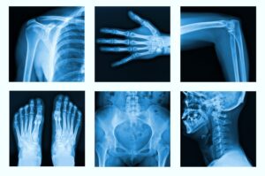 Collage of many X-rays in very good quality.