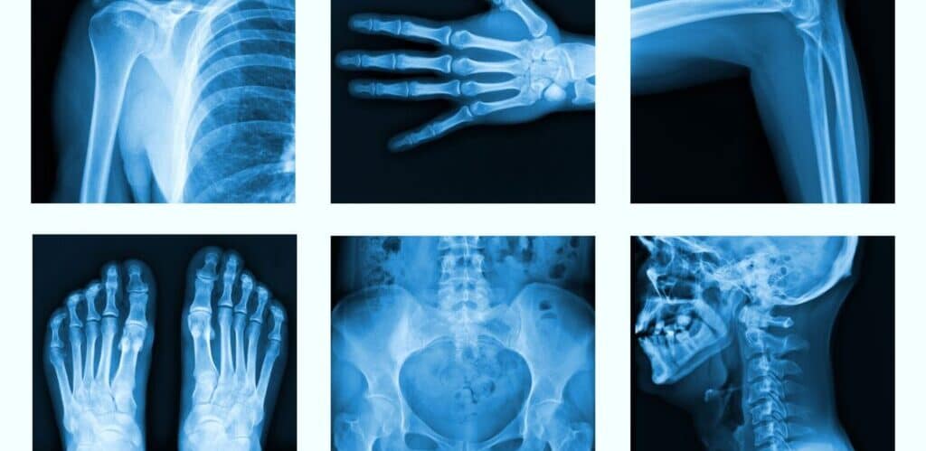 Collage of many X-rays in very good quality.