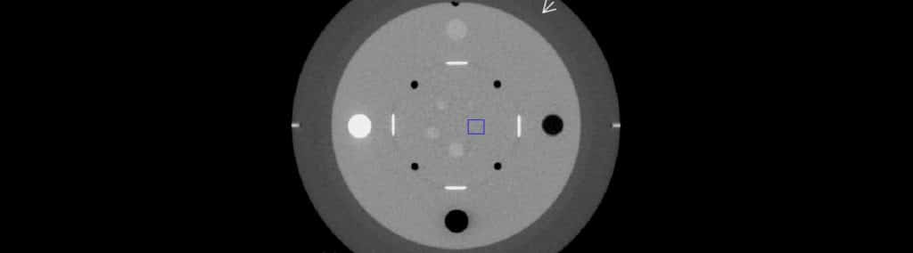 CT Scanner Calibration, the Core of CT Maintenance | Amber Diagnostics